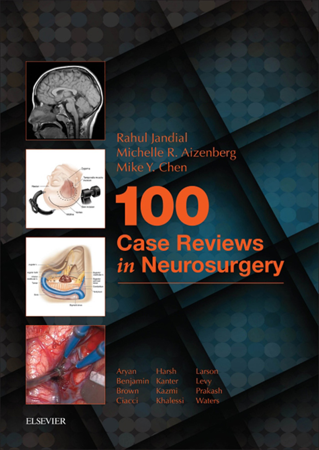 100 Case Reviews in Neurosurgery 1st Edition â€“ PDF/EPUB Version Downloadable