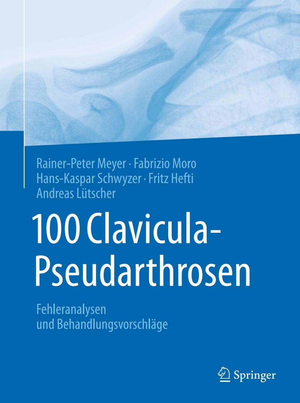100 Clavicula-Pseudarthrosen Fehleranalysen und BehandlungsvorschlÃ¤ge  â€“ PDF/EPUB Version Downloadable
