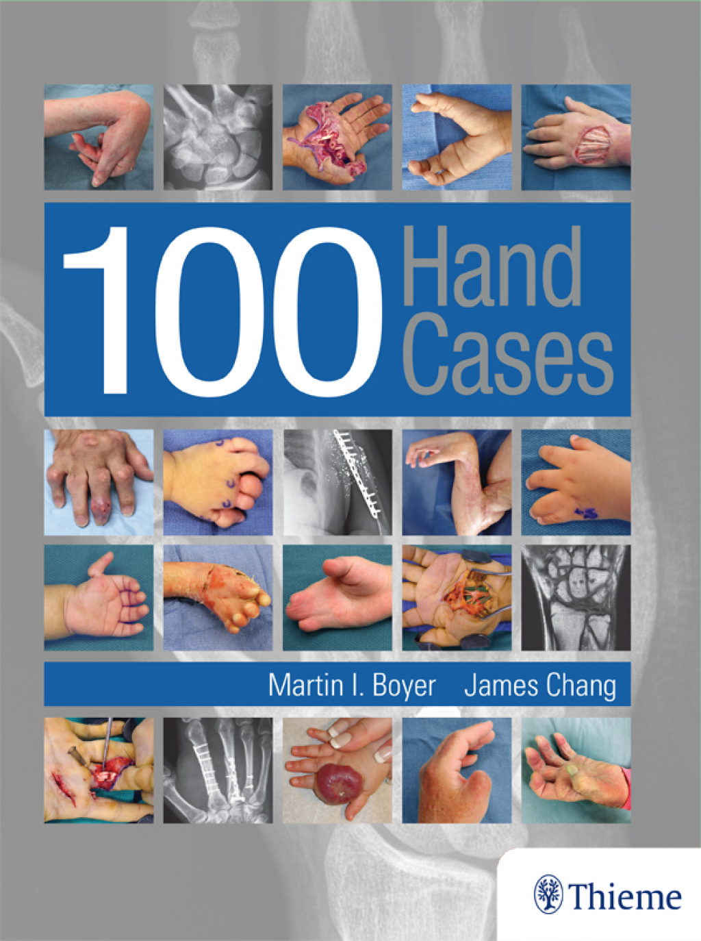 100 Hand Cases 1st Edition â€“ PDF/EPUB Version Downloadable