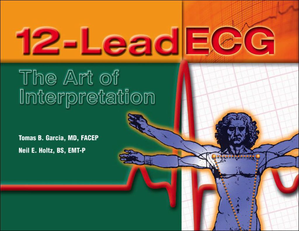 12-Lead ECG 1st Edition â€“ PDF/EPUB Version Downloadable