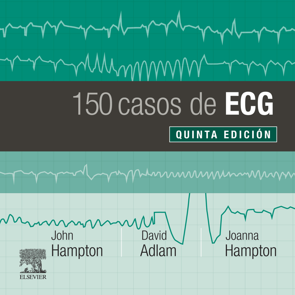 150 casos de ECG 5th Edition - (PDF/EPUB Version)