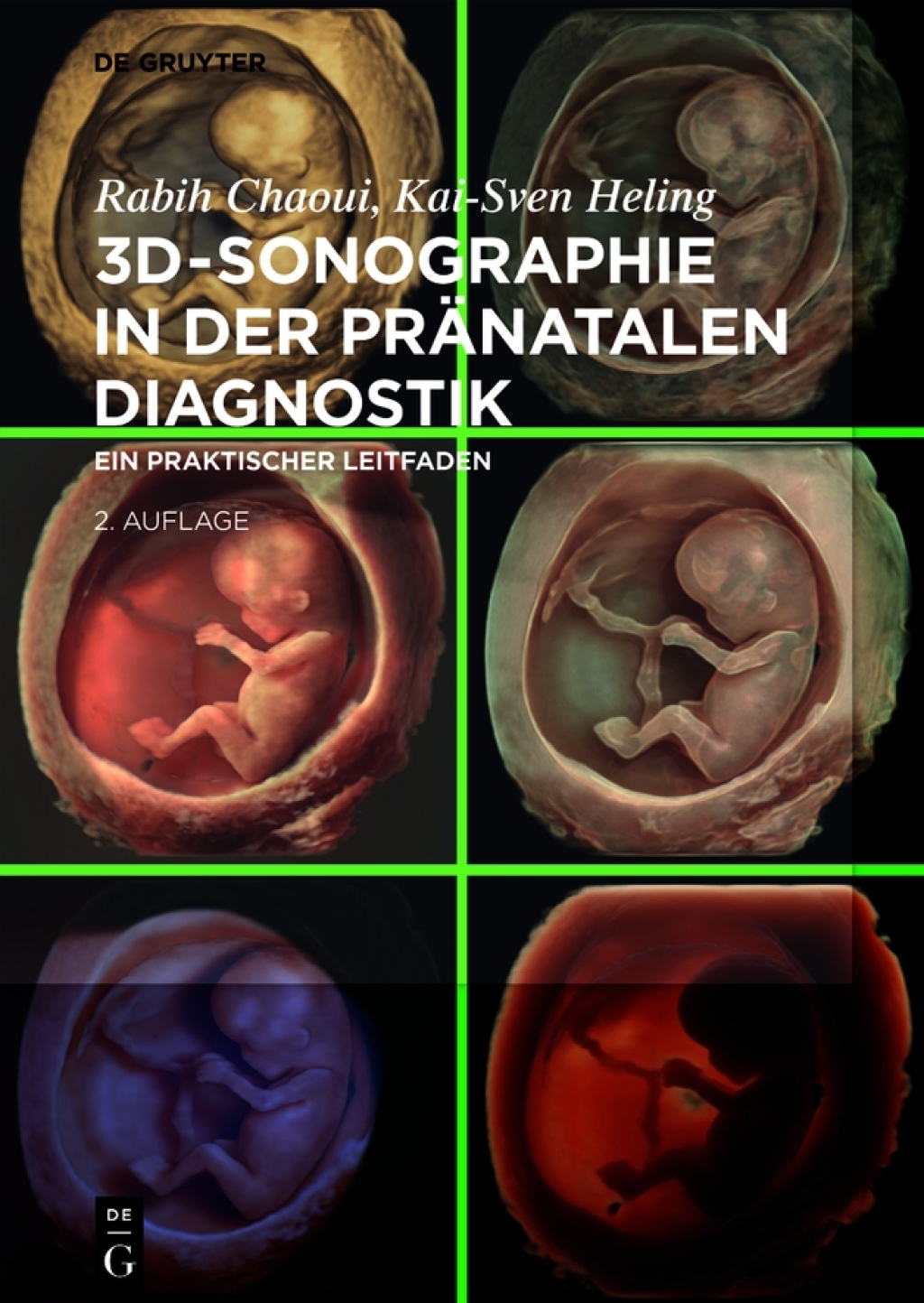 3D-Sonographie in der prÃ¤natalen Diagnostik Ein praktischer Leitfaden 2nd Edition â€“ PDF/EPUB Version Downloadable