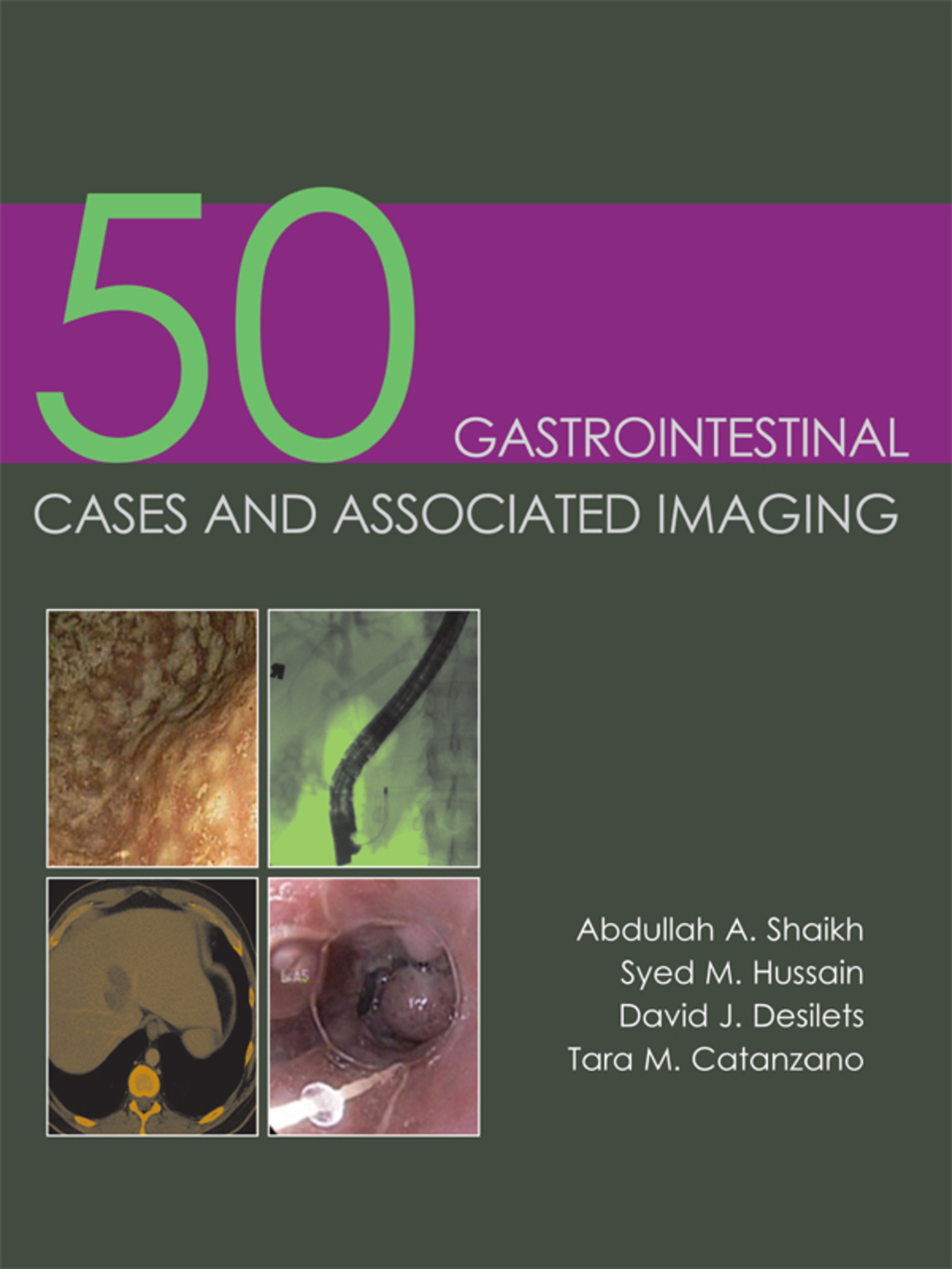 50 Gastrointestinal Cases and Associated Imaging 1st Edition â€“ PDF/EPUB Version Downloadable