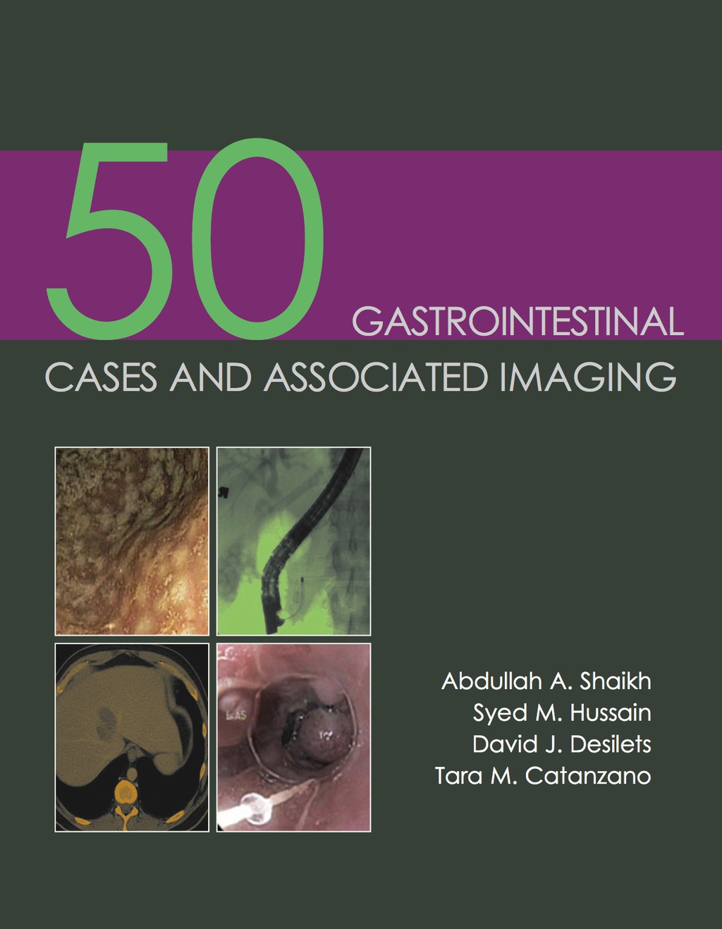 50 Gastrointestinal Cases and Associated Imaging 1st Edition â€“ PDF/EPUB Version Downloadable