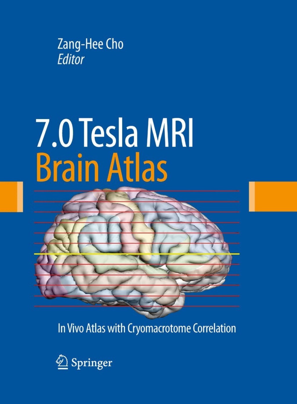 7.0 Tesla MRI Brain Atlas In Vivo Atlas with Cryomacrotome Correlation ...