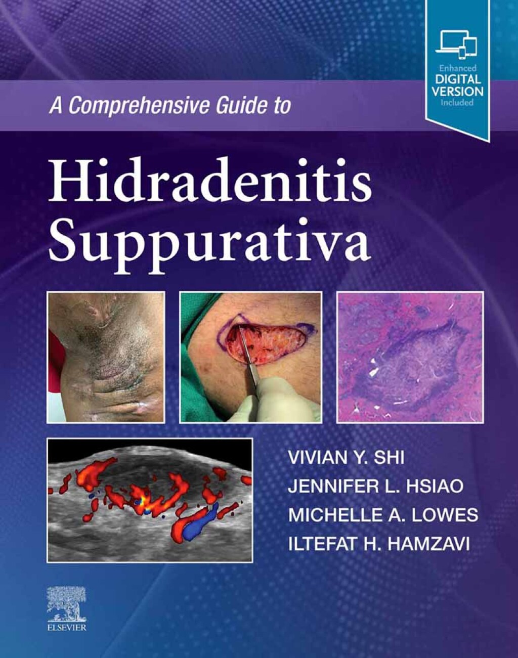 A Comprehensive Guide to Hidradenitis Suppurativa â€“ PDF/EPUB Version Downloadable