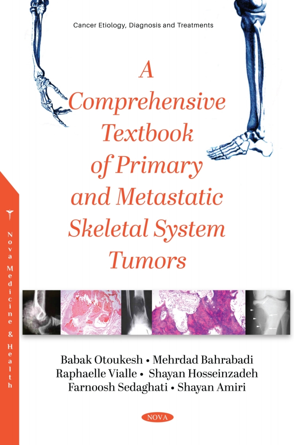 A Comprehensive Textbook of Primary and Metastatic Tumors of the Skeletal System â€“ PDF/EPUB Version Downloadable