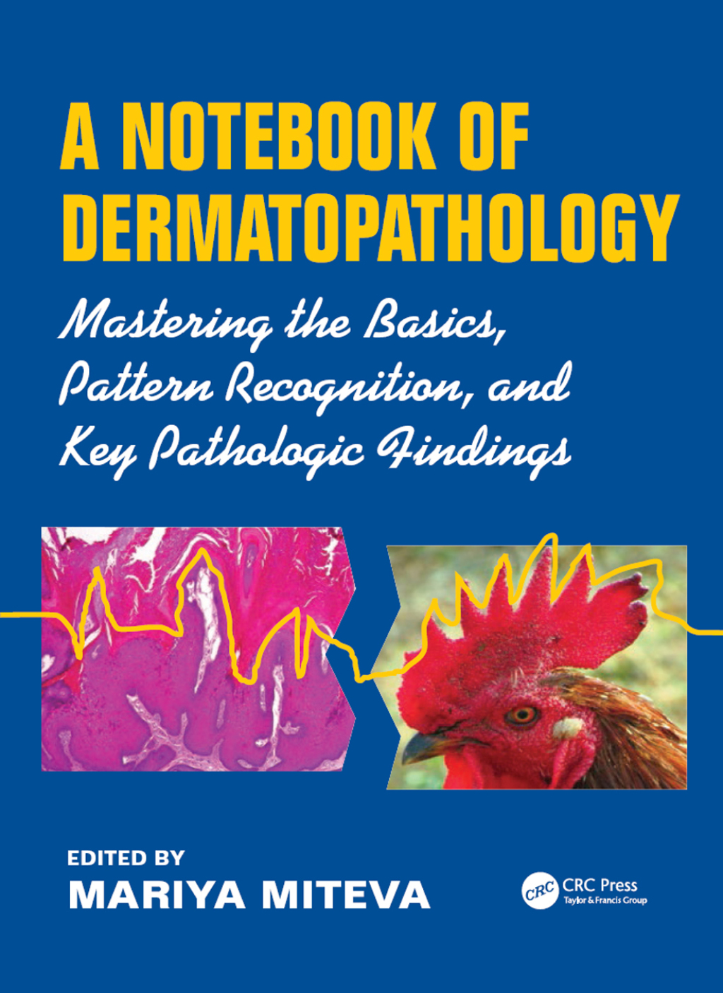 A Notebook of Dermatopathology Mastering the Basics, Pattern Recognition, and Key Pathologic Findings 1st Edition â€“ PDF/EPUB Version Downloadable
