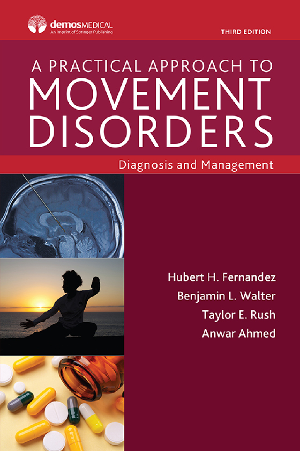 A Practical Approach to Movement Disorders Diagnosis and Management, Third Edition 3rd Edition â€“ PDF/EPUB Version Downloadable