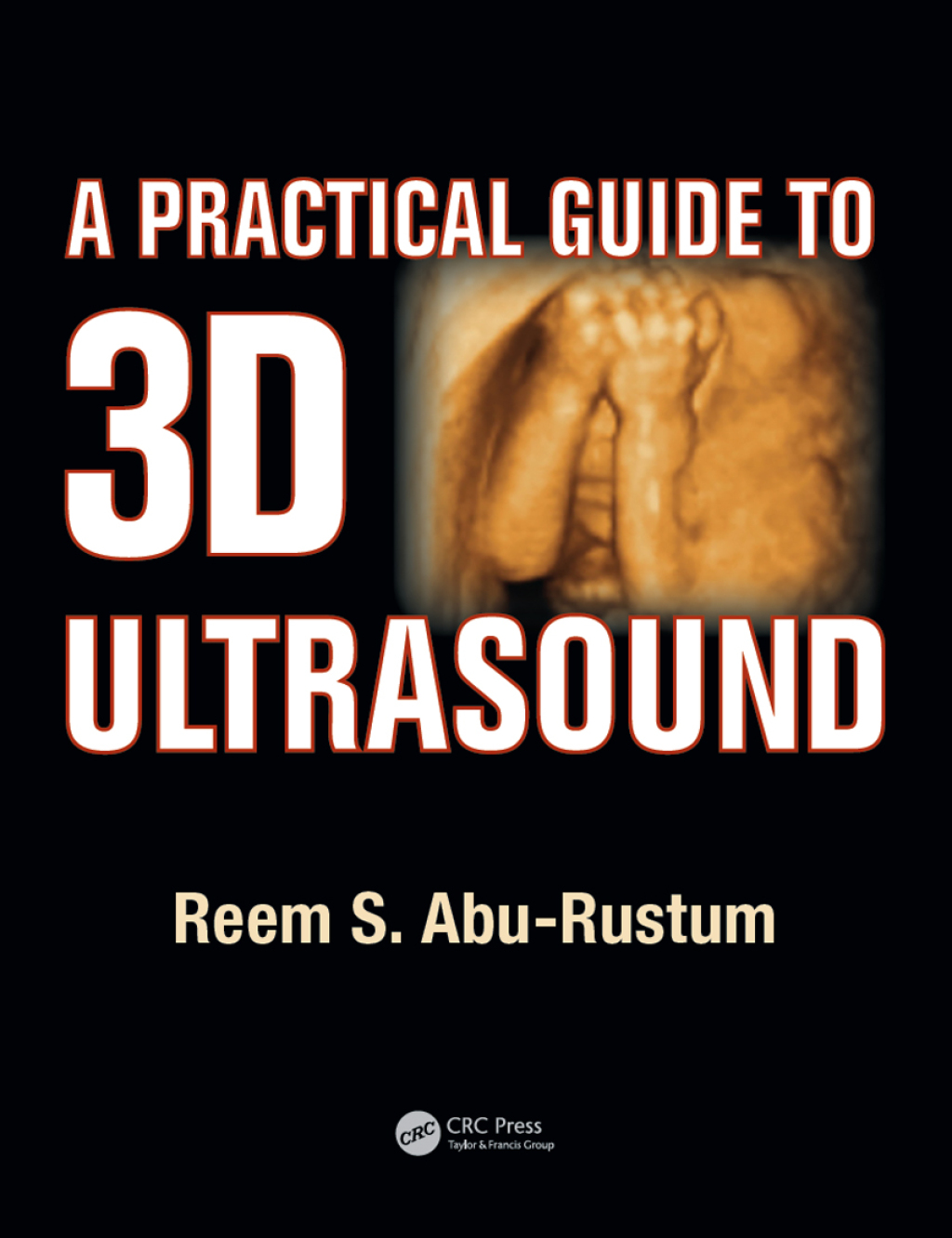 A Practical Guide to 3D Ultrasound 1st Edition â€“ PDF/EPUB Version Downloadable