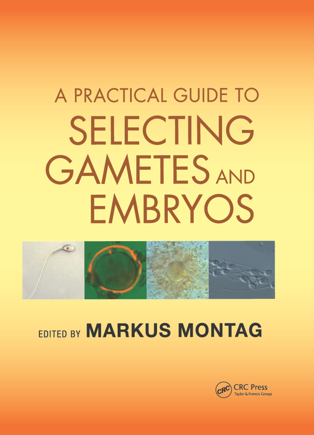A Practical Guide to Selecting Gametes and Embryos 1st Edition â€“ PDF/EPUB Version Downloadable