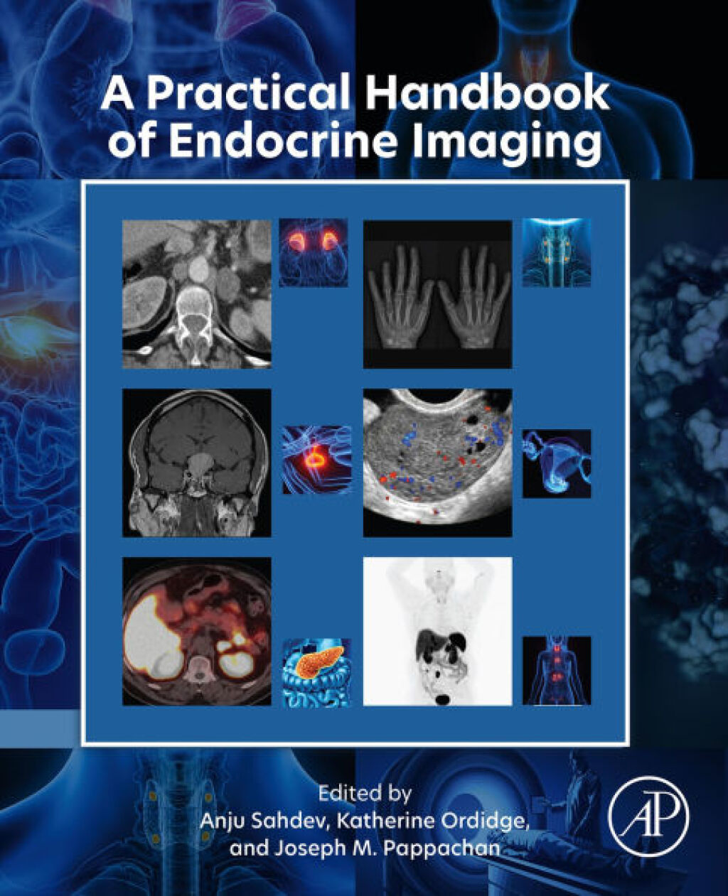A Practical Handbook of Endocrine Imaging â€“ PDF/EPUB Version Downloadable