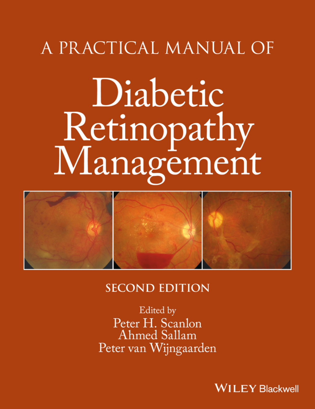 A Practical Manual of Diabetic Retinopathy Management 2nd Edition â€“ PDF/EPUB Version Downloadable