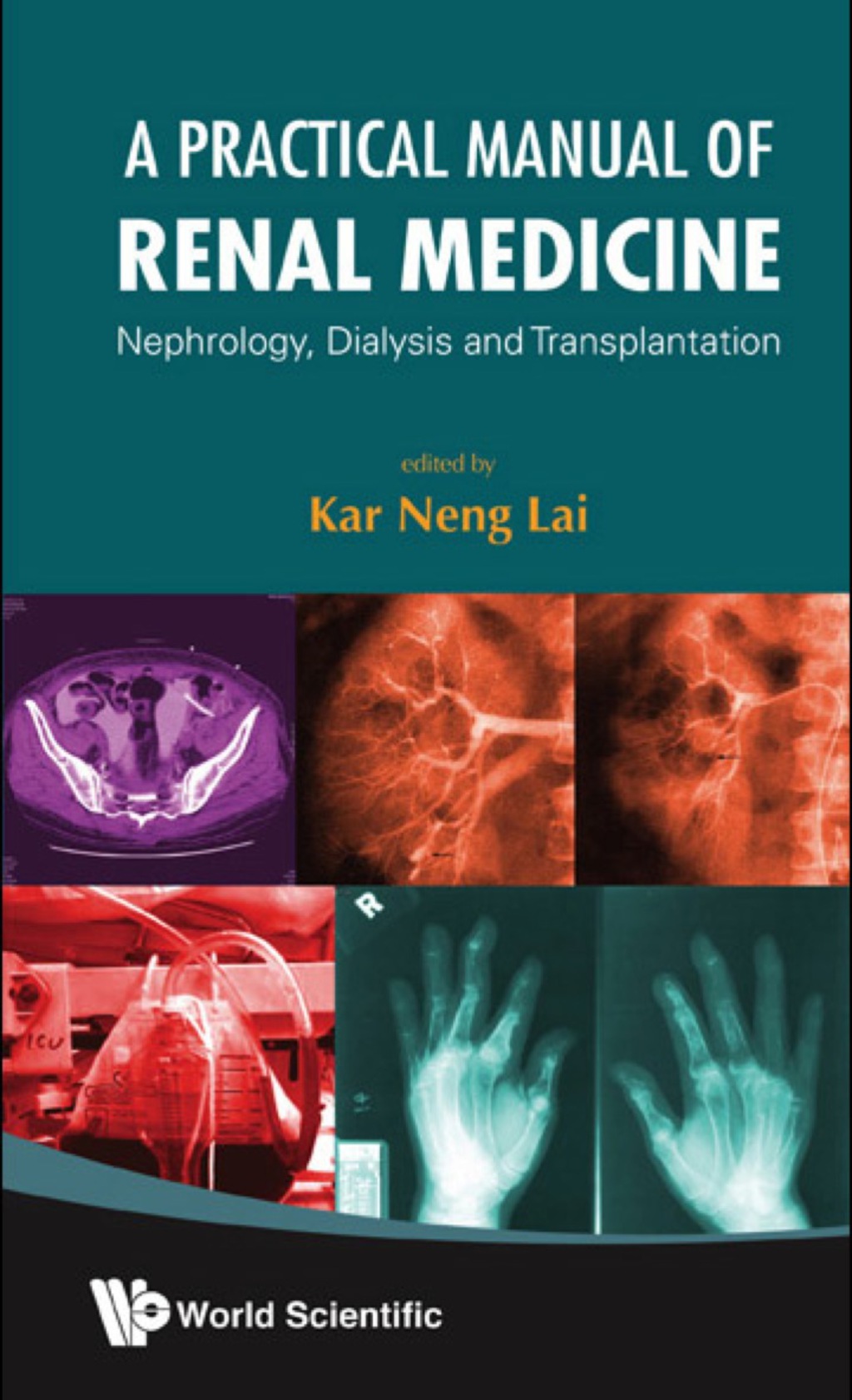 A Practical Manual of Renal Medicine: Nephrology, Dialysis And Transplantation  â€“ PDF/EPUB Version Downloadable