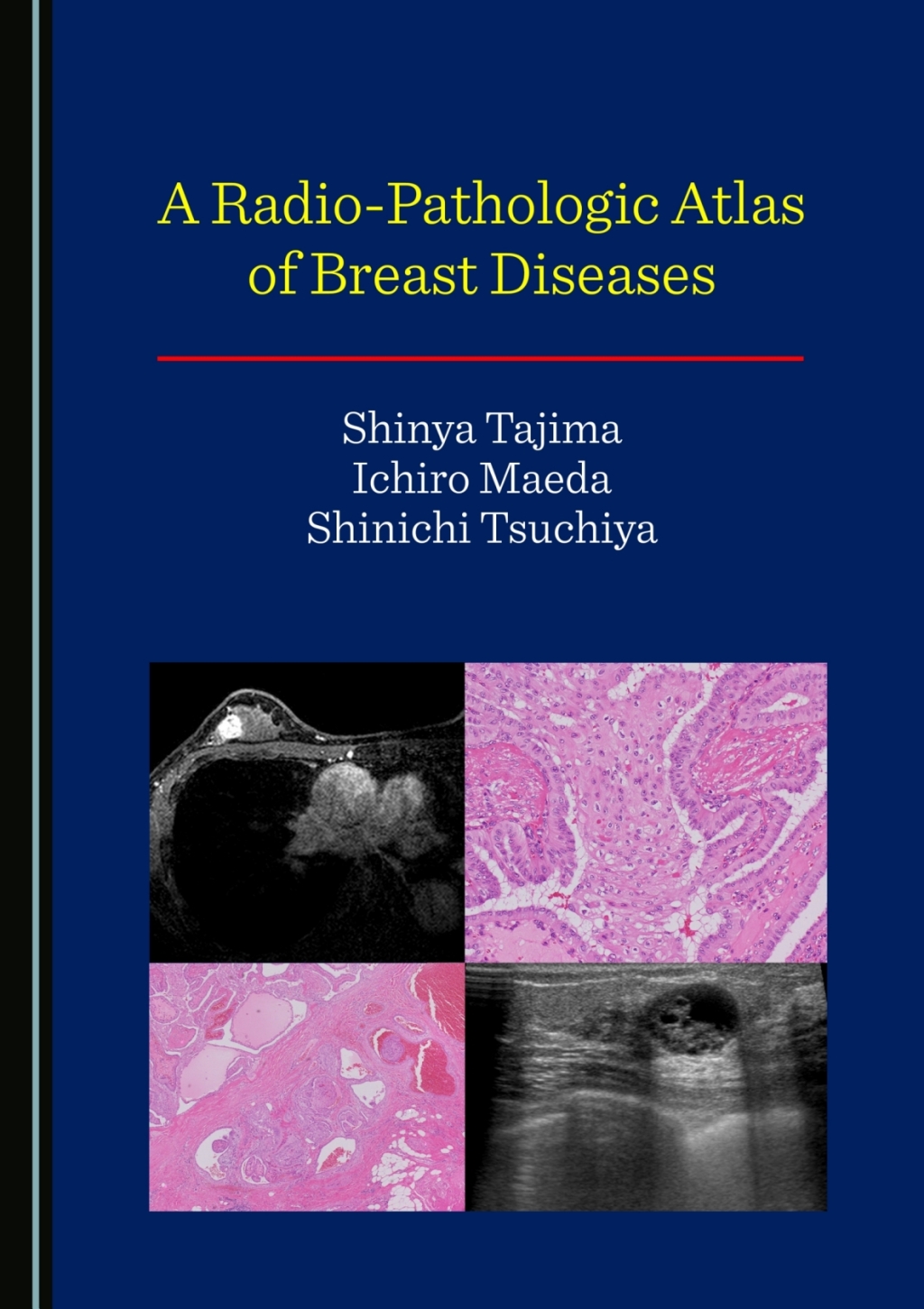 A Radio-Pathologic Atlas of Breast Diseases 1st Edition â€“ PDF/EPUB Version Downloadable