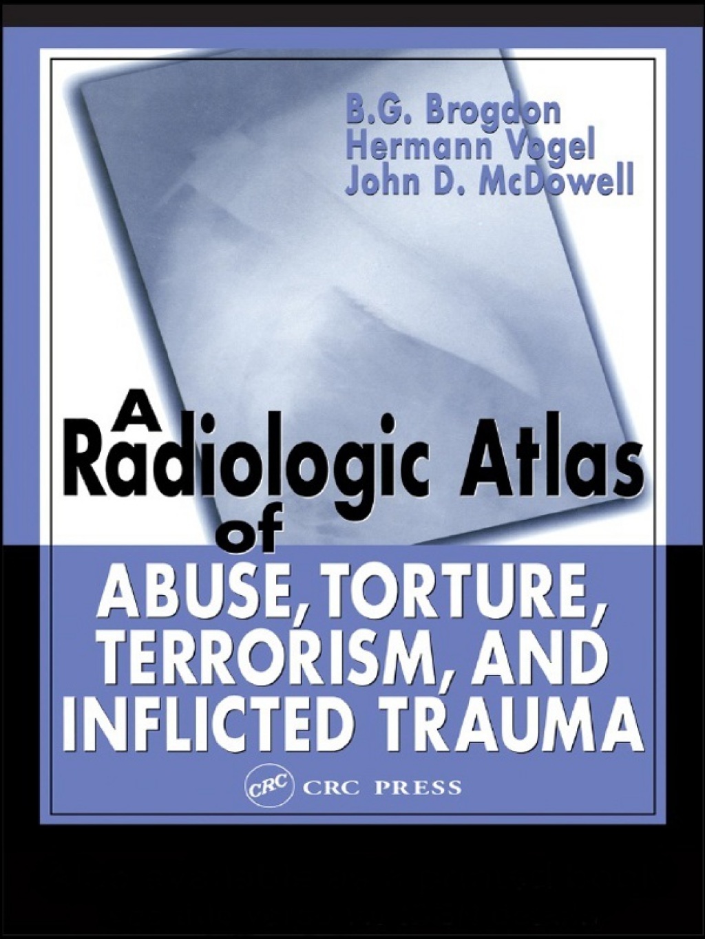 A Radiologic Atlas of Abuse, Torture, Terrorism, and Inflicted Trauma 1st Edition â€“ PDF/EPUB Version Downloadable