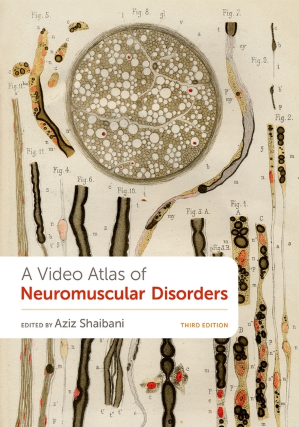 A Video Atlas of Neuromuscular Disorders 3rd Edition â€“ PDF/EPUB Version Downloadable