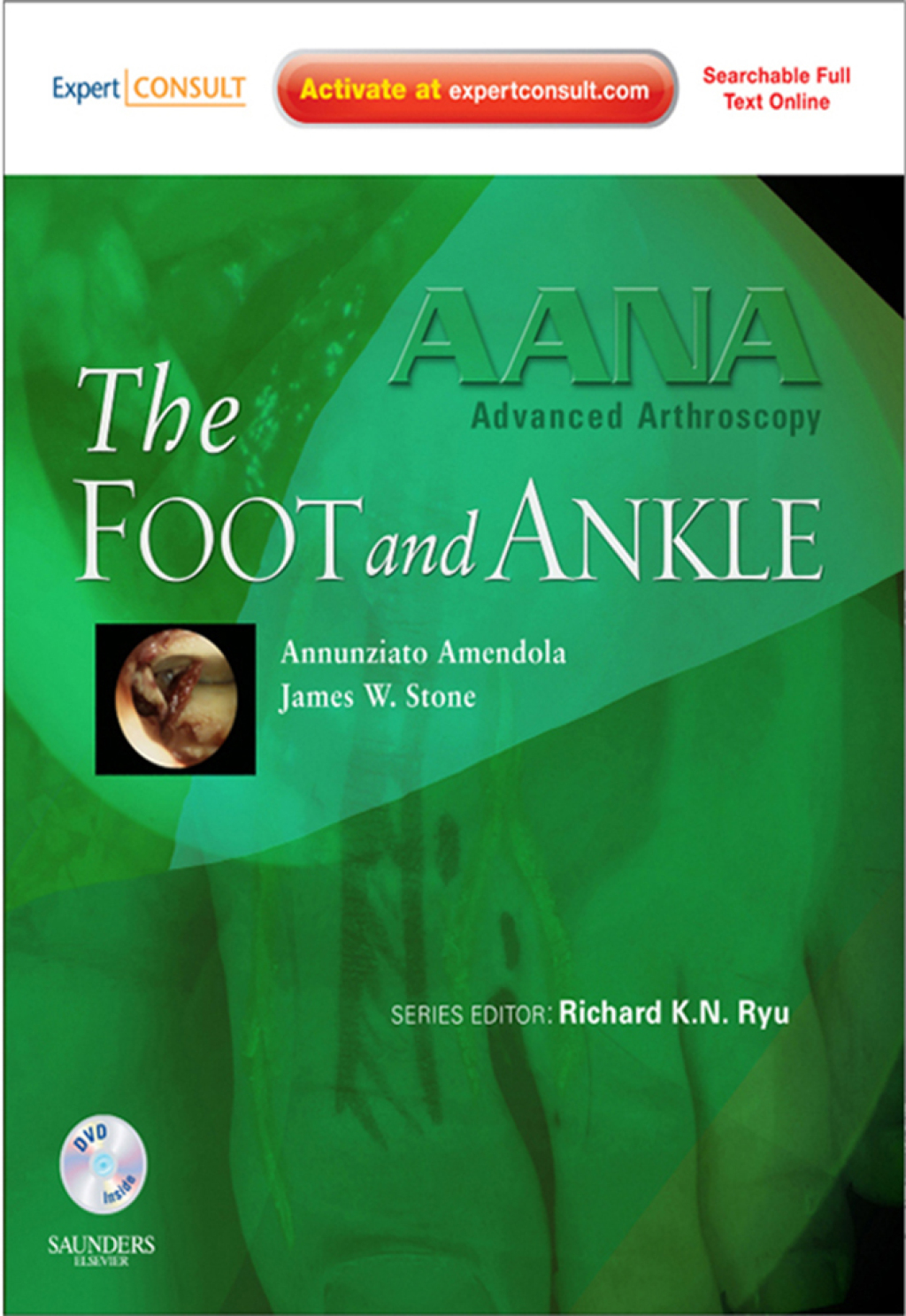 AANA Advanced Arthroscopy: The Foot and Ankle - Electronic 1st Edition â€“ PDF/EPUB Version Downloadable