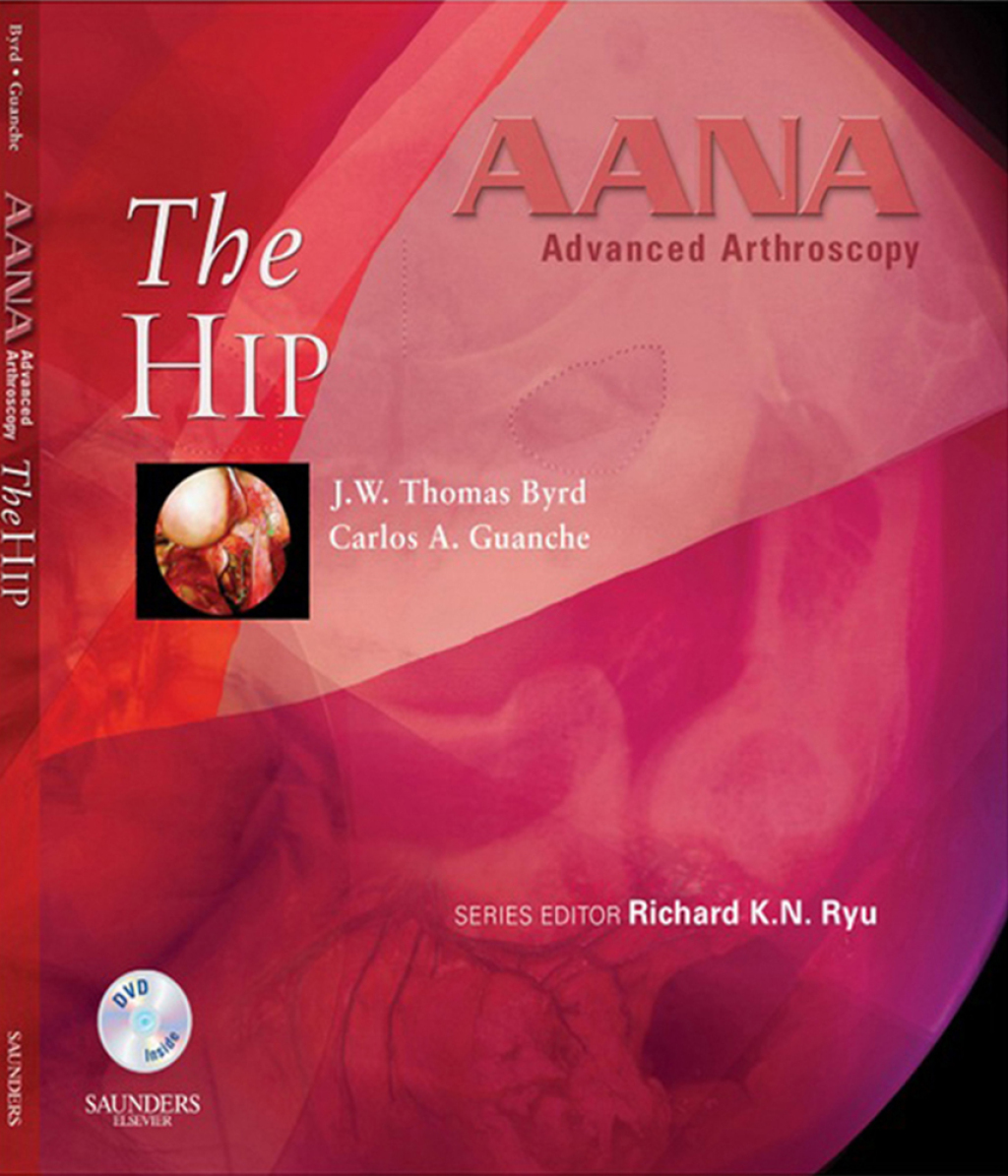 AANA Advanced Arthroscopy: The Hip 1st Edition â€“ PDF/EPUB Version Downloadable