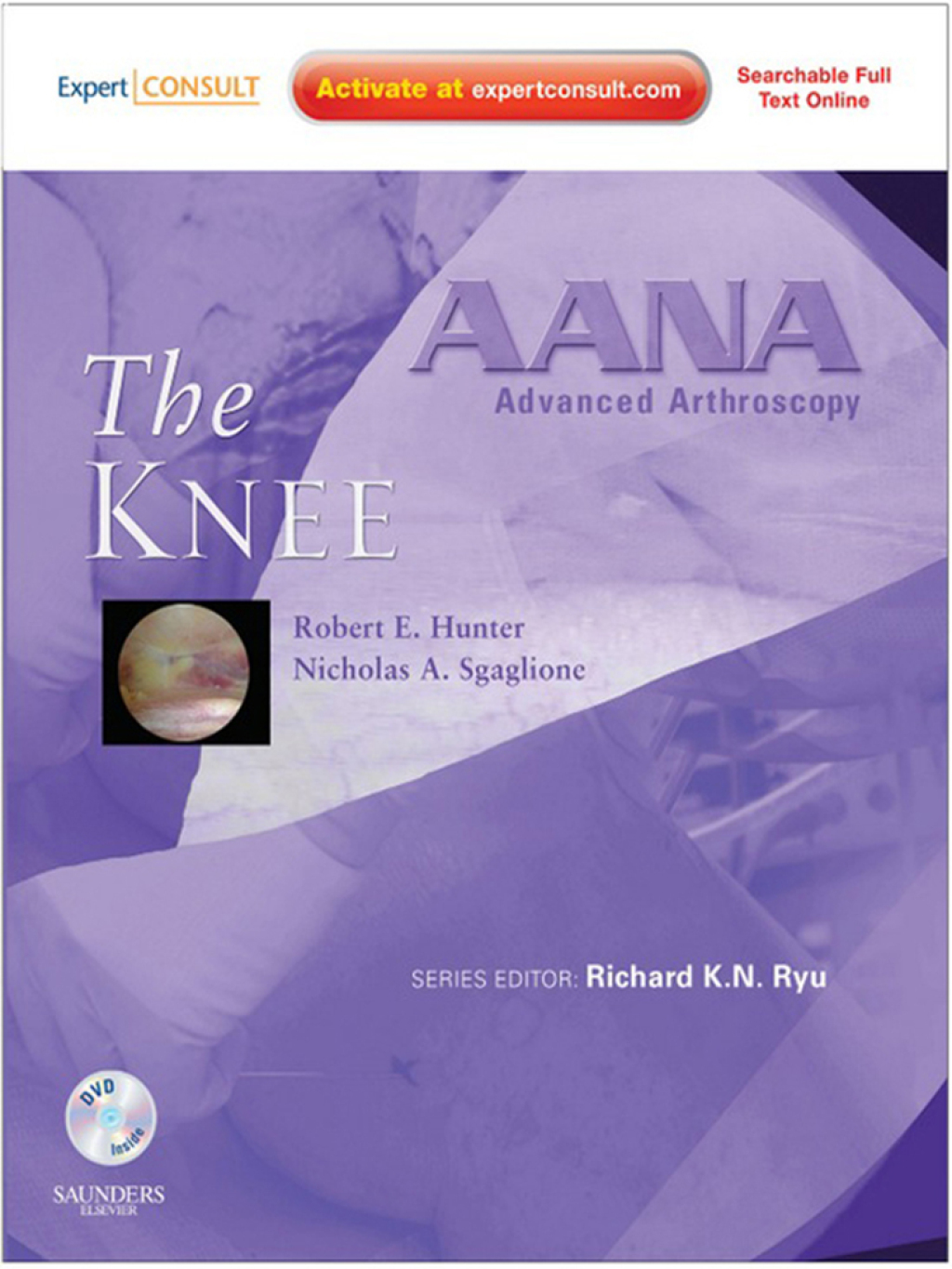 AANA Advanced Arthroscopy: The Knee â€“ PDF/EPUB Version Downloadable