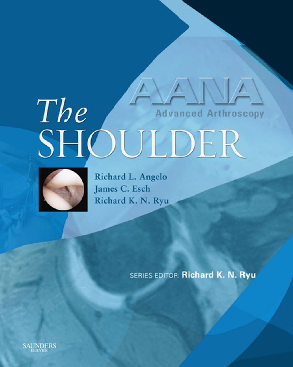 AANA Advanced Arthroscopy: The Shoulder - Electronic 1st Edition â€“ PDF/EPUB Version Downloadable