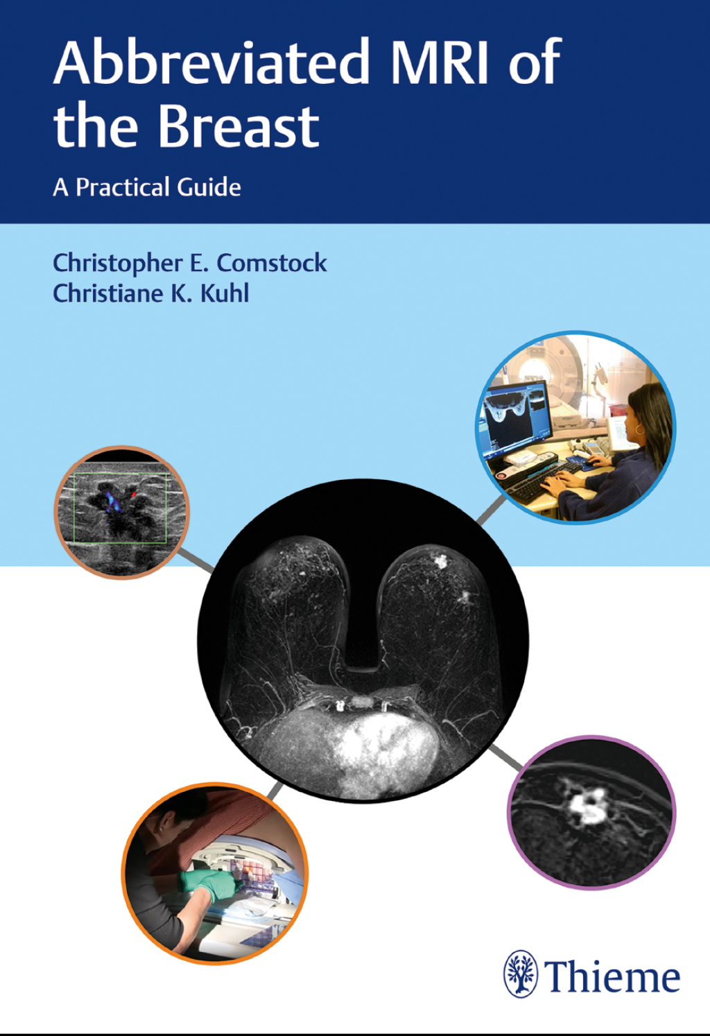 Abbreviated MRI of the Breast A Practical Guide 1st Edition â€“ PDF ...