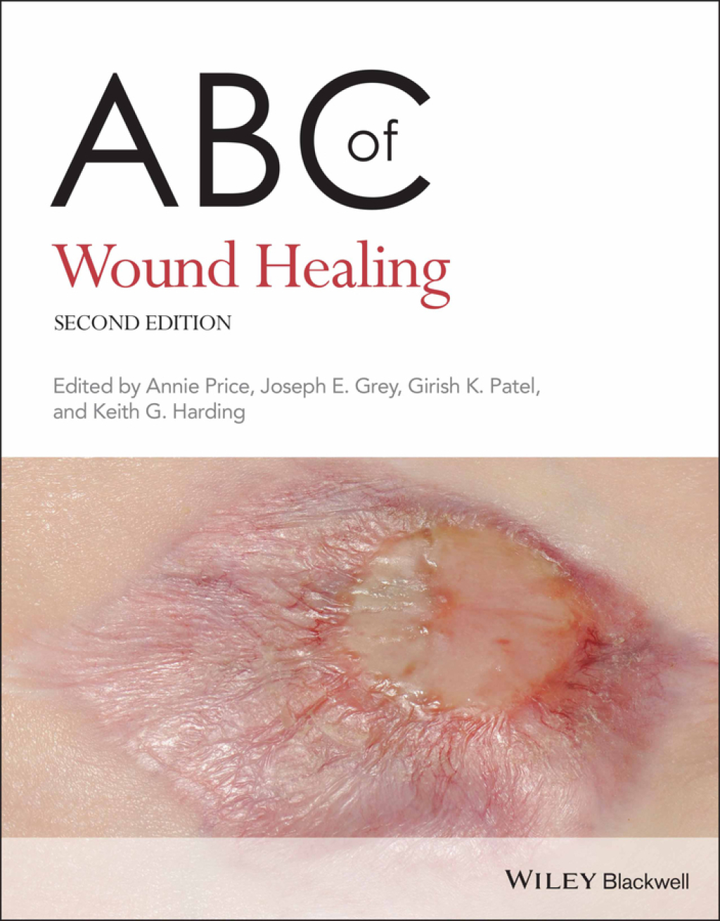 ABC of Wound Healing 2nd Edition - (PDF/EPUB Version)