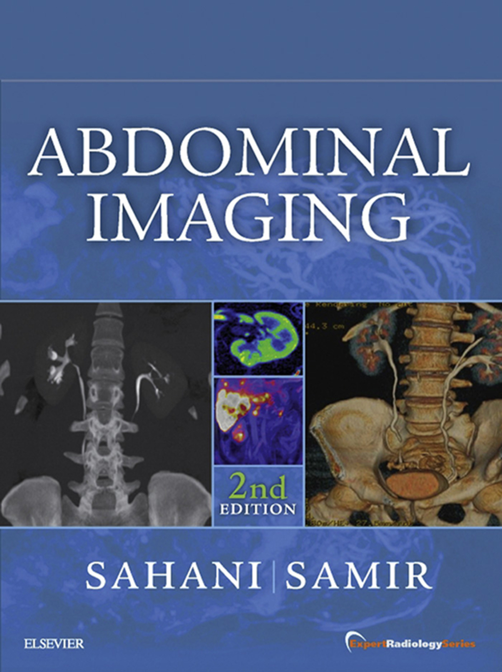Abdominal Imaging: Expert Radiology Series 2nd Edition â€“ PDF/EPUB Version Downloadable