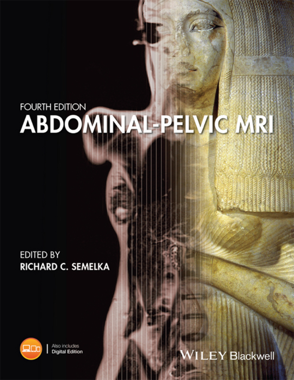 Abdominal-Pelvic MRI 4th Edition â€“ PDF/EPUB Version Downloadable