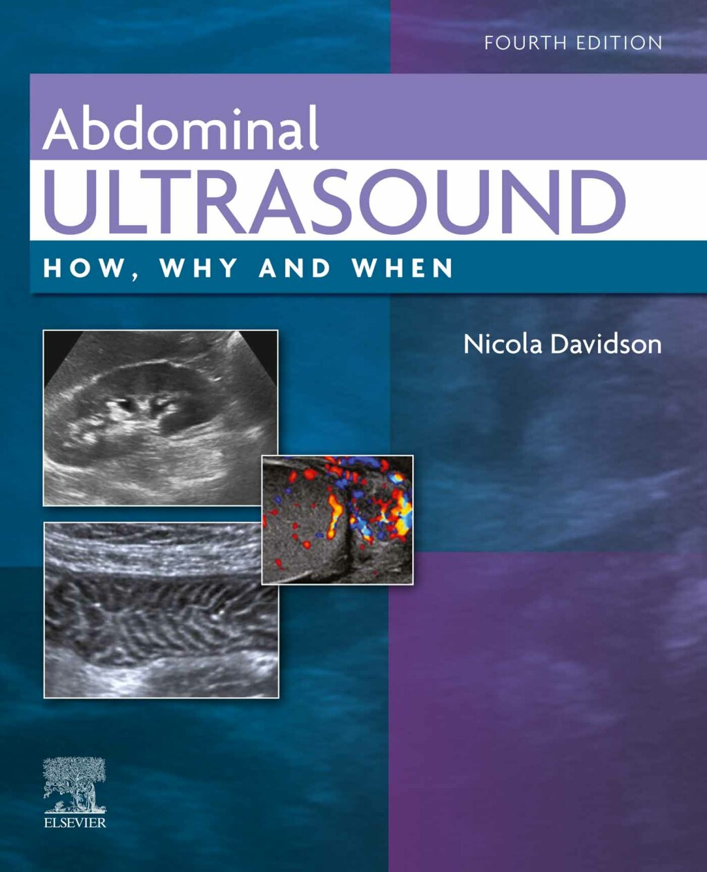 Abdominal Ultrasound How, Why and When 4th Edition â€“ PDF/EPUB Version Downloadable