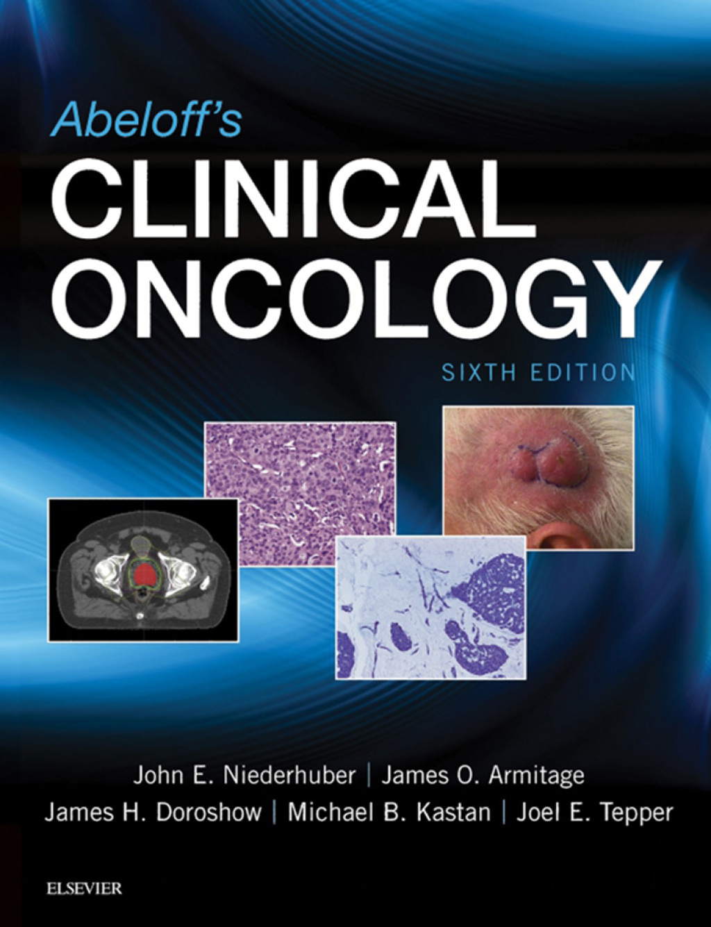 Abeloff's Clinical Oncology E-Book 6th Edition â€“ PDF/EPUB Version Downloadable