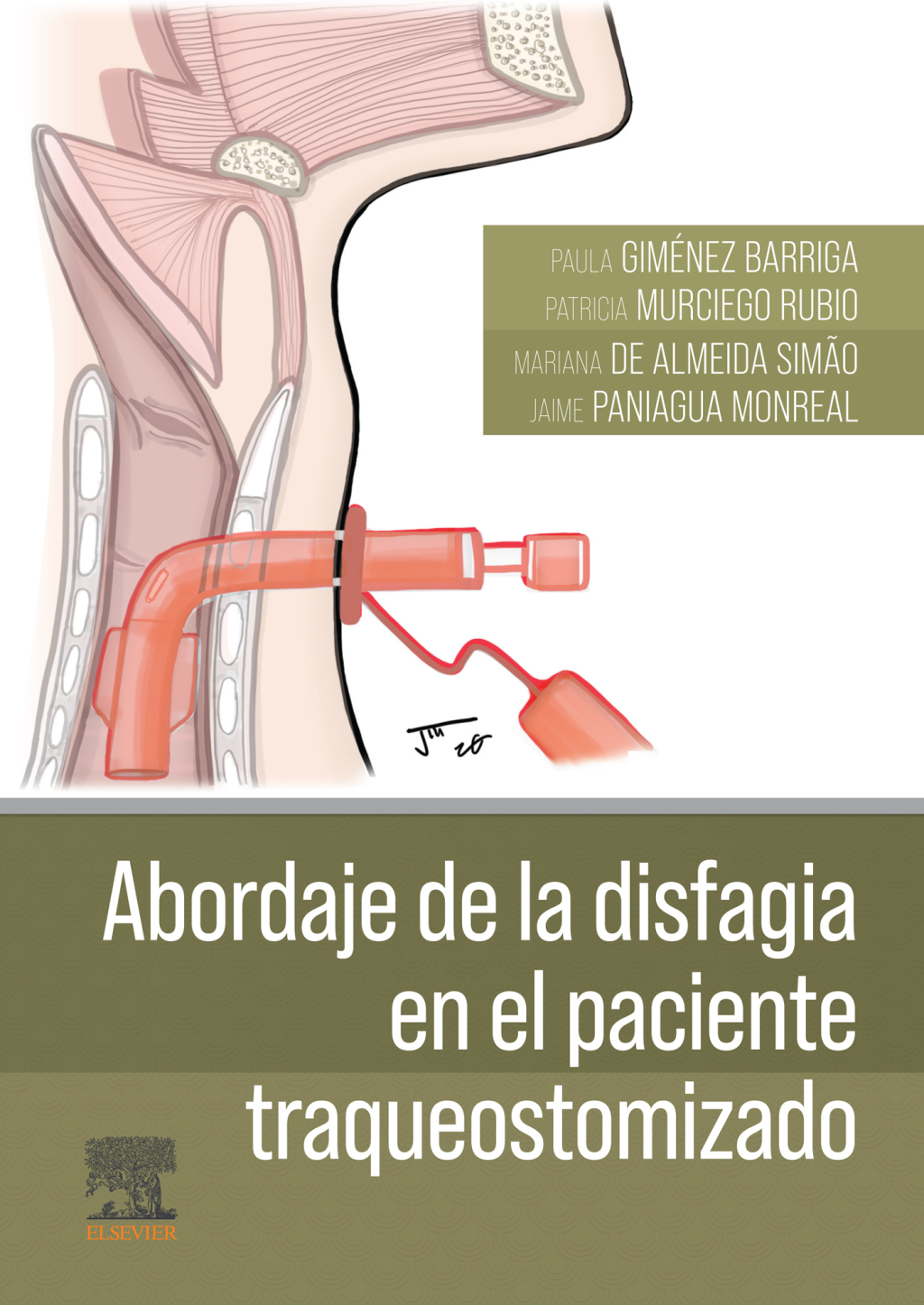 Abordaje de la disfagia en el paciente traqueostomizado 1st Edition â€“ PDF/EPUB Version Downloadable