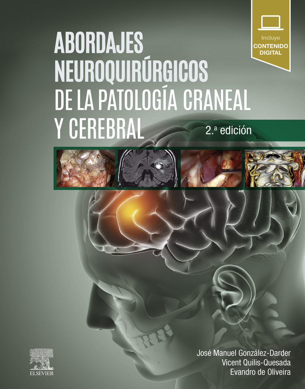 Abordajes neuroquirÃºrgicos de la patologÃ­a craneal y cerebral 2nd Edition â€“ PDF/EPUB Version Downloadable