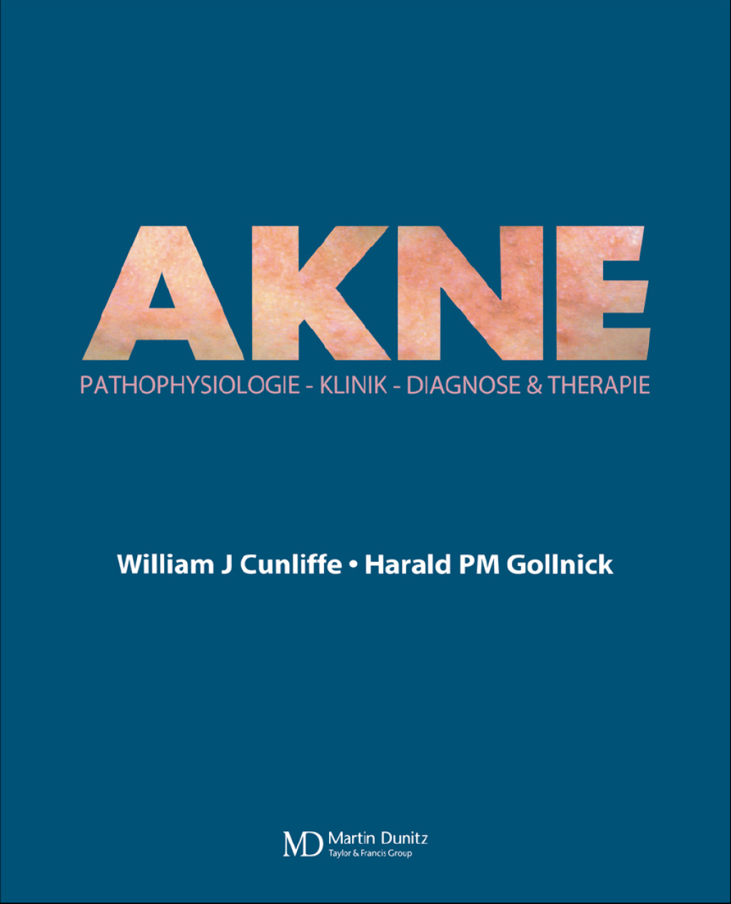 Acne Diagnose und Therapie 1st Edition â€“ PDF/EPUB Version Downloadable