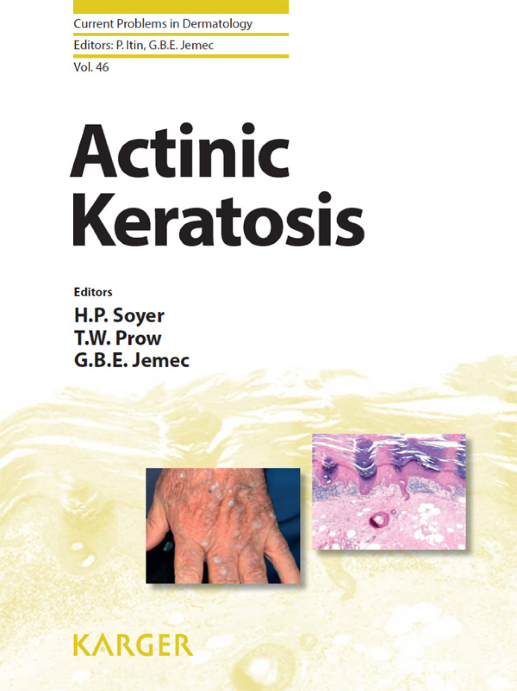 Actinic Keratosis 1st Edition â€“ PDF/EPUB Version Downloadable