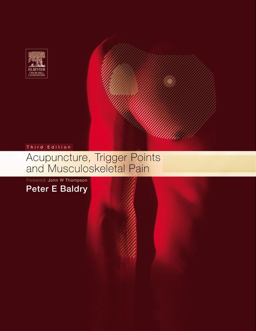 Acupuncture, Trigger Points and Musculoskeletal Pain 3rd Edition â€“ PDF/EPUB Version Downloadable