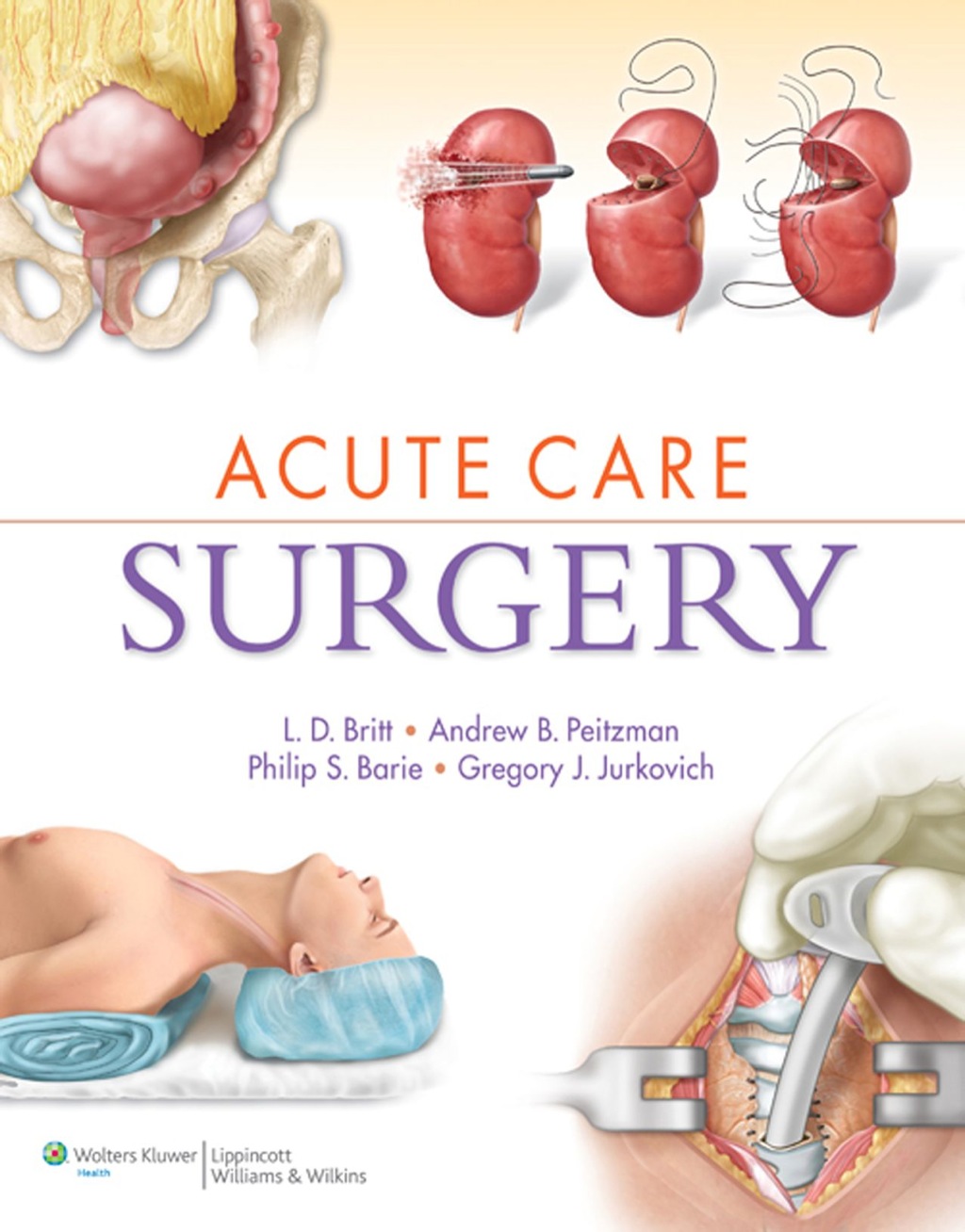 Acute Care Surgery 1st Edition â€“ PDF/EPUB Version Downloadable