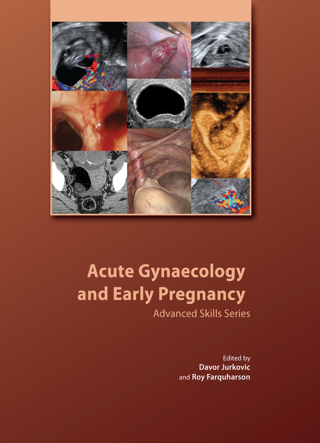 Acute Gynaecology and Early Pregnancy â€“ PDF/EPUB Version Downloadable