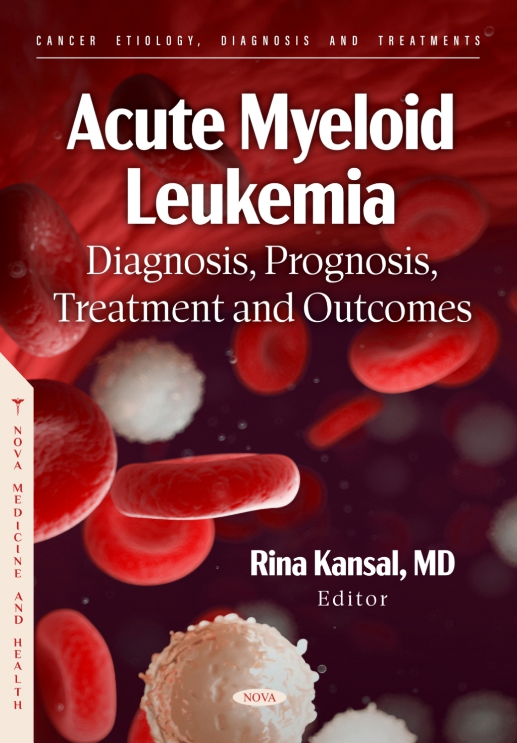 Acute Myeloid Leukemia: Diagnosis, Prognosis, Treatment and Outcomes â€“ PDF/EPUB Version Downloadable