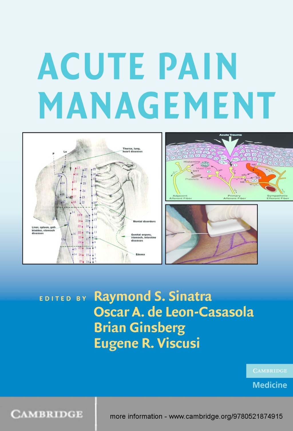 Acute Pain Management 1st Edition â€“ PDF/EPUB Version Downloadable