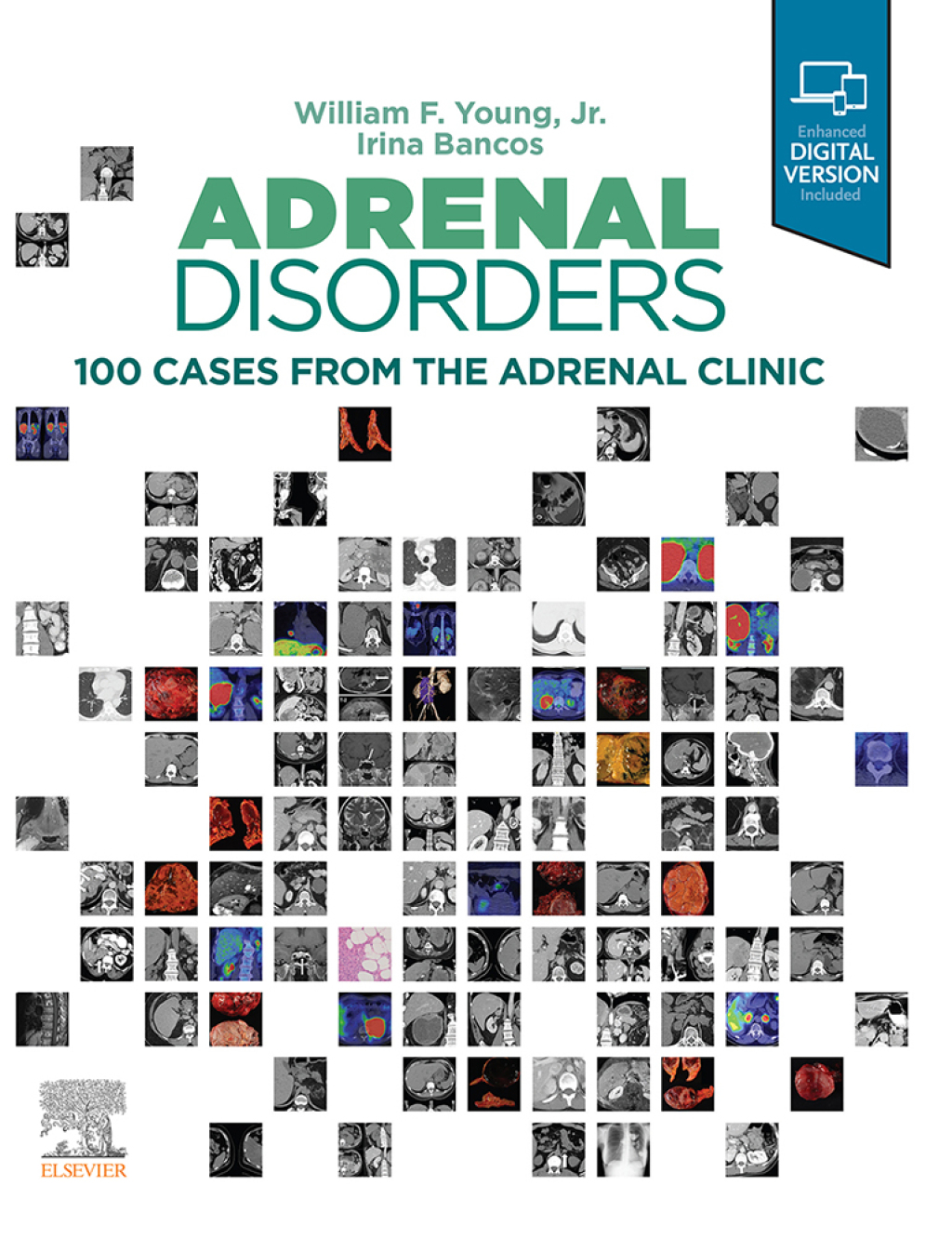 Adrenal Disorders,E-Book Cases from the Adrenal Clinic â€“ PDF/EPUB Version Downloadable