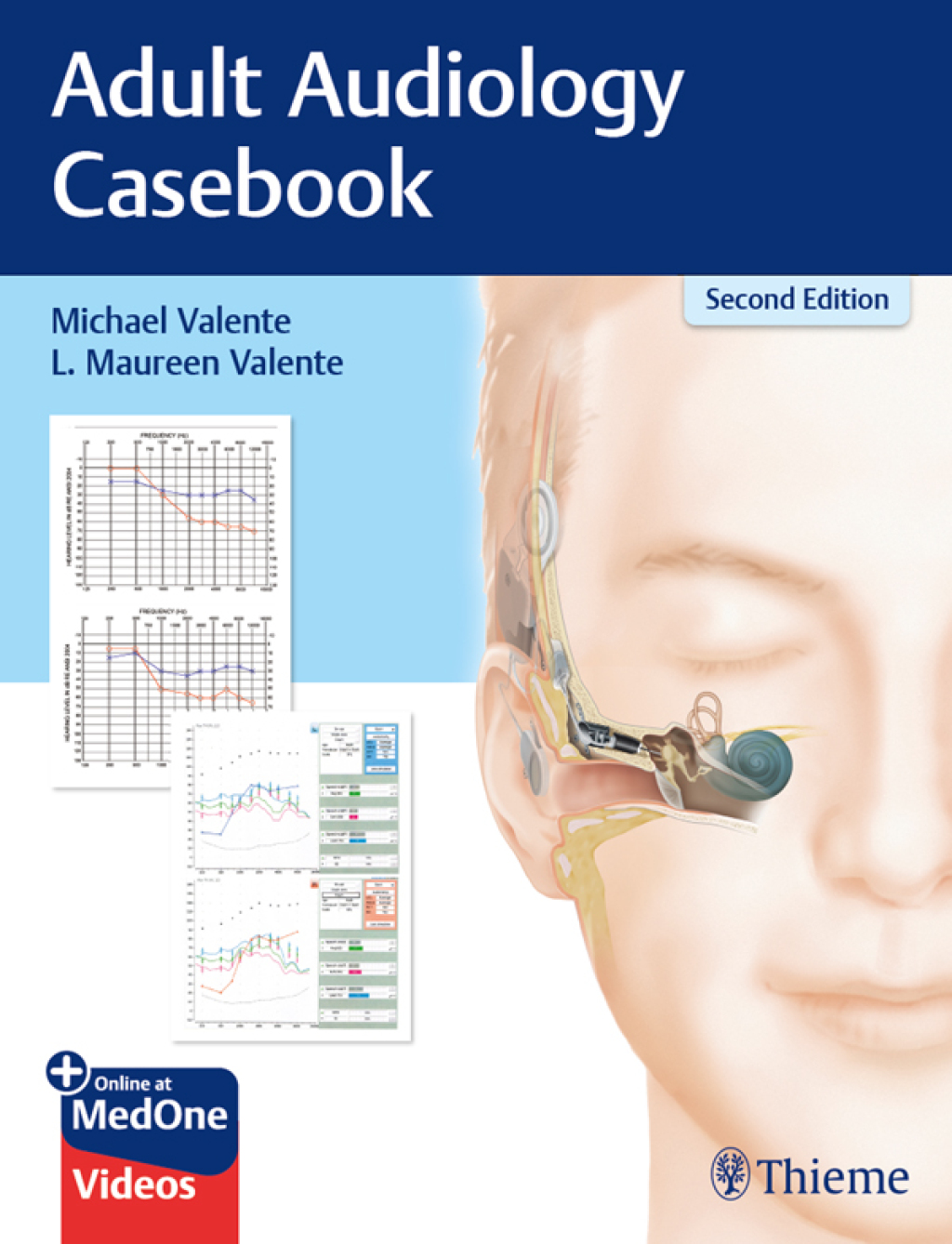 Adult Audiology Casebook 2nd Edition â€“ PDF/EPUB Version Downloadable