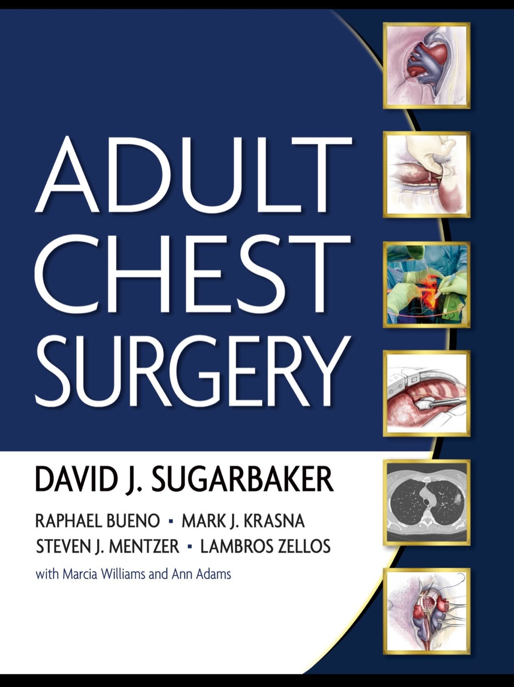 Adult Chest Surgery 1st Edition â€“ PDF/EPUB Version Downloadable