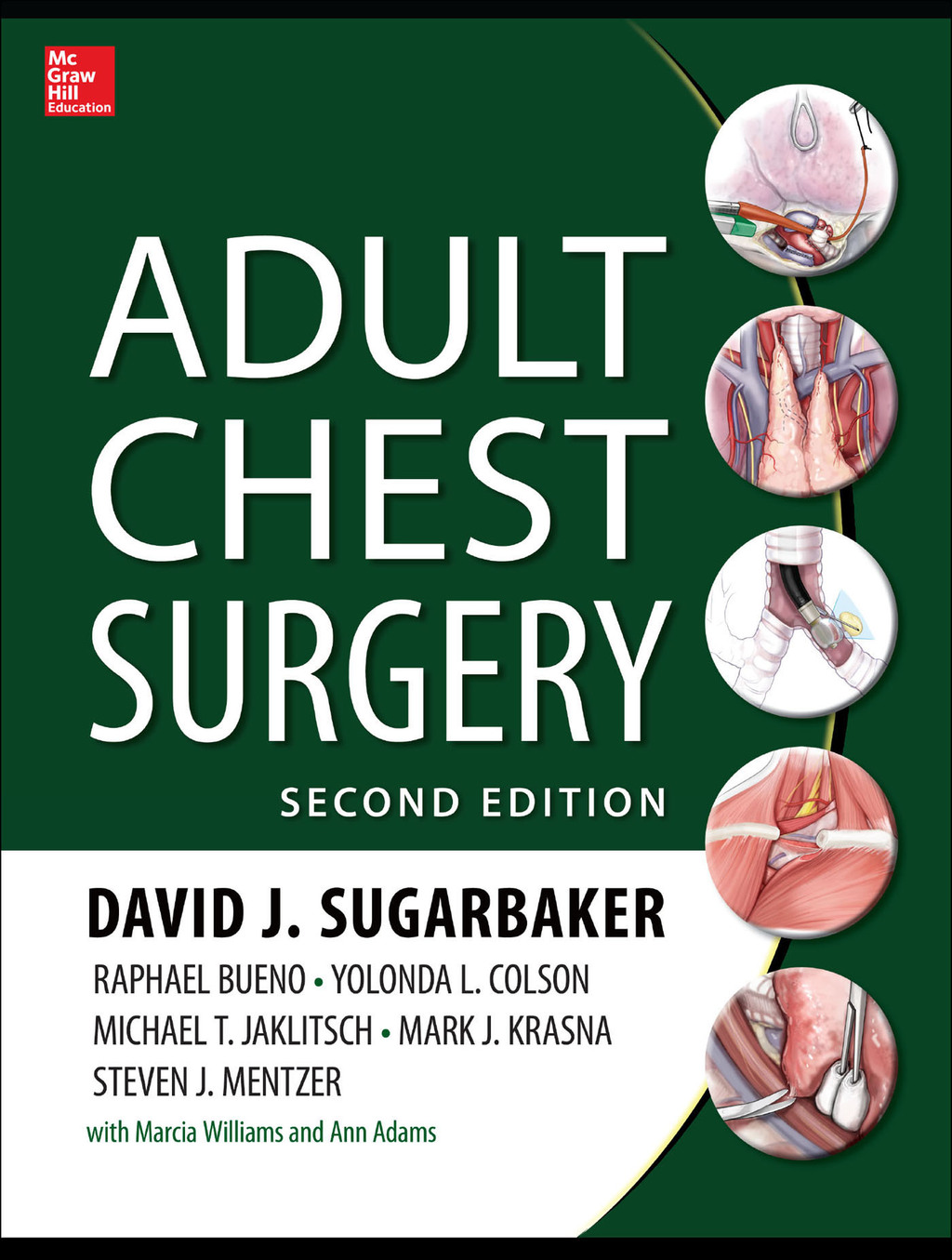 Adult Chest Surgery, 2nd edition 2nd Edition â€“ PDF/EPUB Version Downloadable