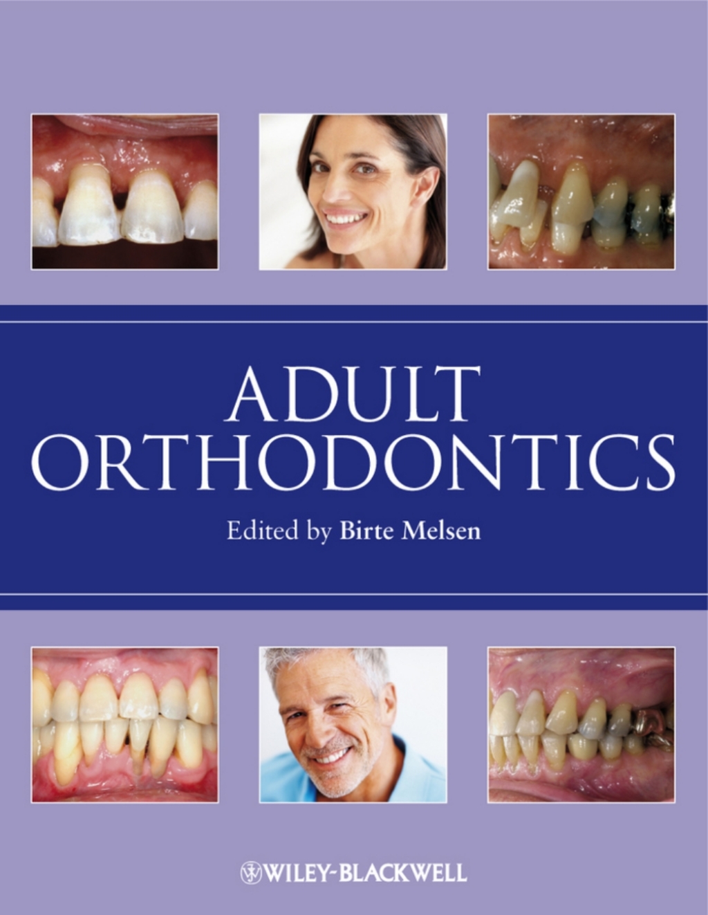 Adult Orthodontics 1st Edition â€“ PDF/EPUB Version Downloadable