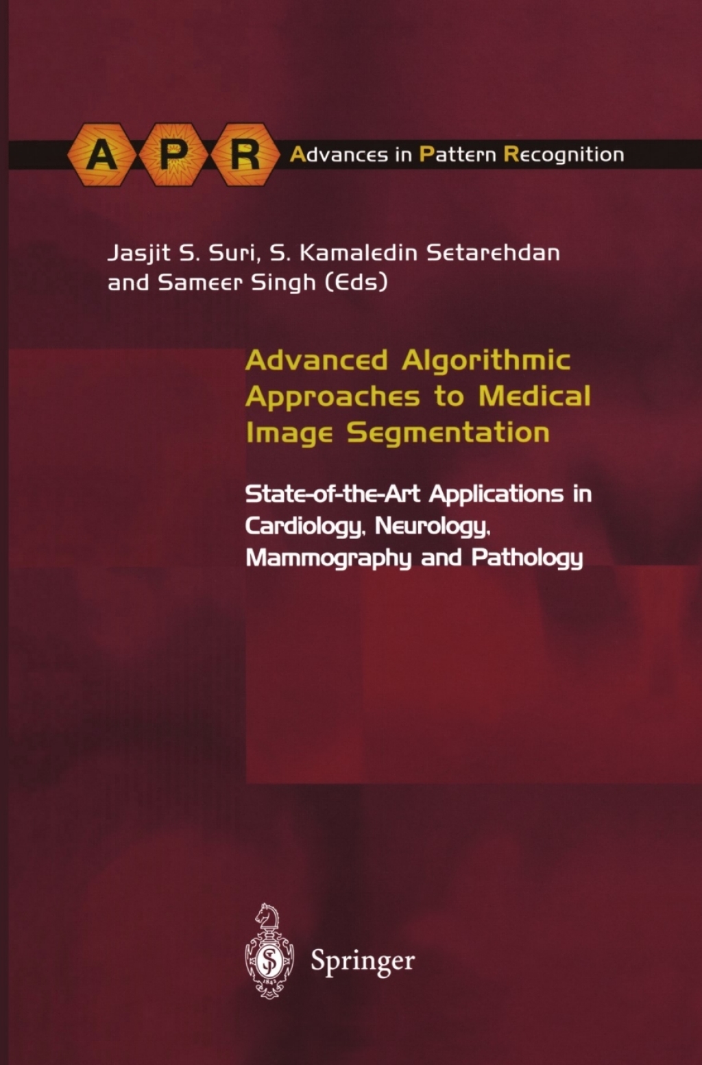Advanced Algorithmic Approaches to Medical Image Segmentation State-of ...