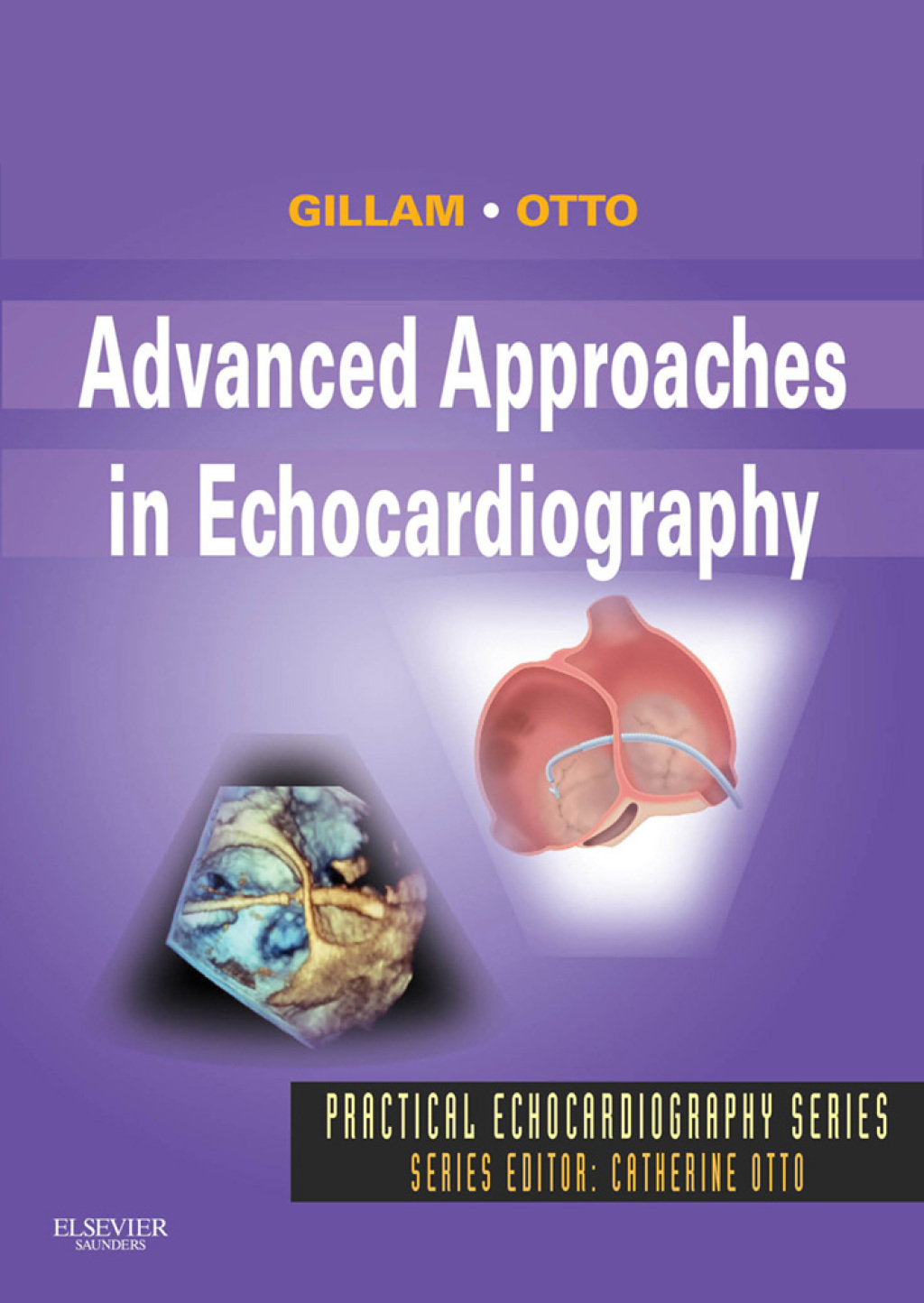 Advanced Approaches in Echocardiography â€“ PDF/EPUB Version Downloadable