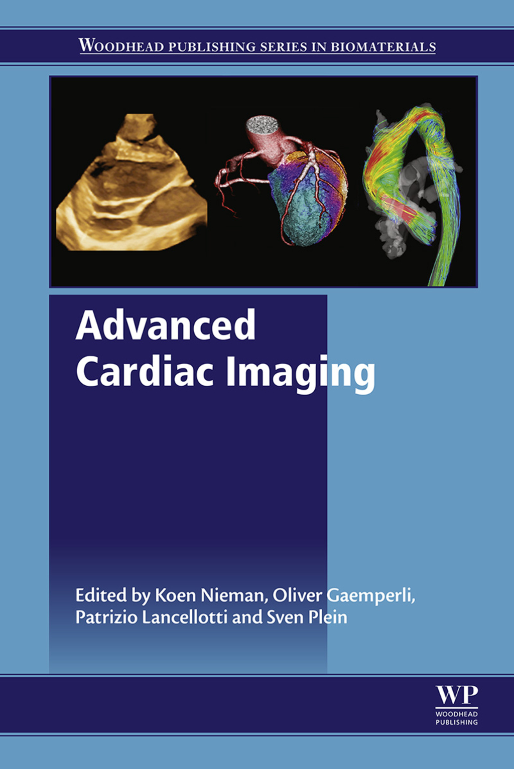 Advanced Cardiac Imaging: Techniques and Applications â€“ PDF/EPUB Version Downloadable