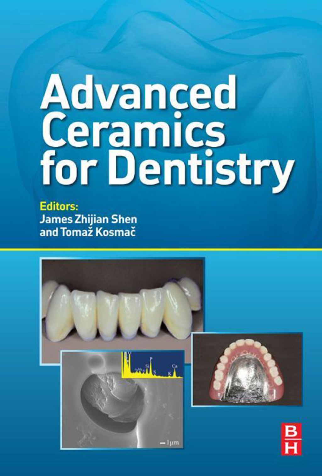 Advanced Ceramics for Dentistry – PDF/EPUB Version Downloadable Advanced Ceramics for Dentistry – PDF/EPUB Version Downloadable - Image 1