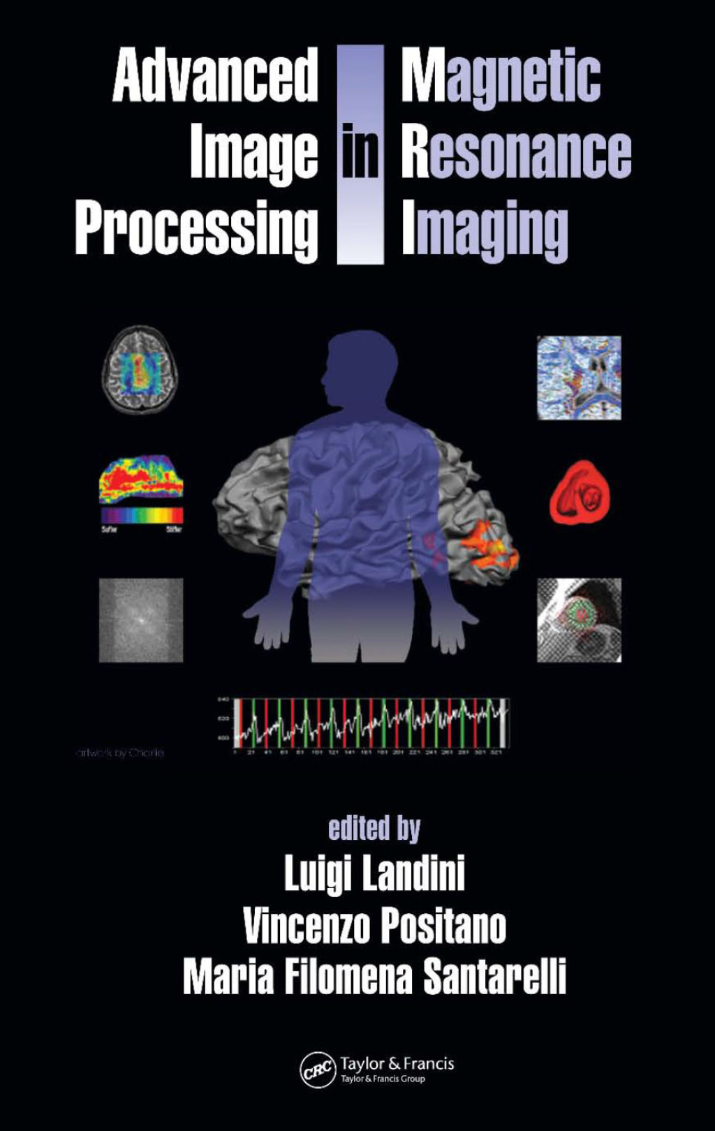Advanced Image Processing in Magnetic Resonance Imaging 1st Edition â ...